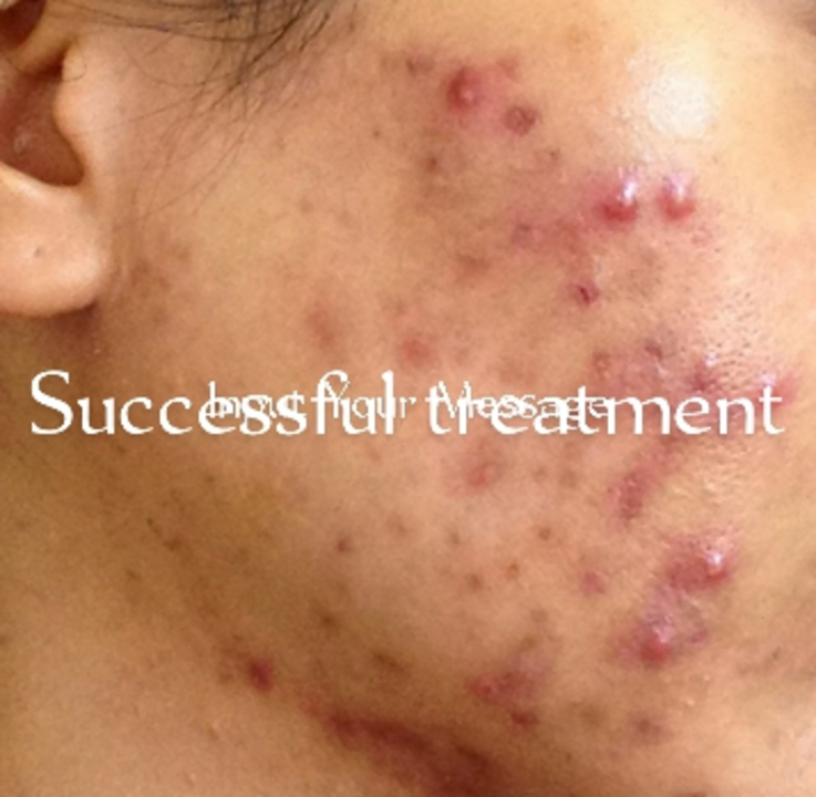 Successful treatment uploaded by business on 8/8/2022
