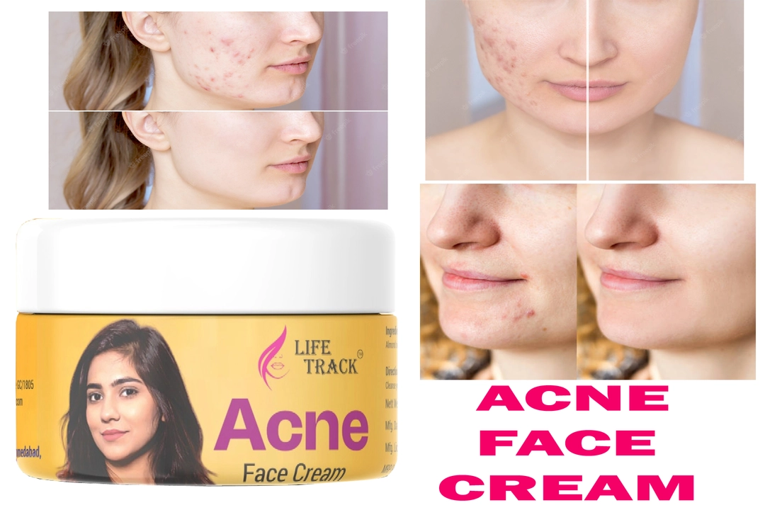 LIFETRACK acne face cream and pimple remove and natural face cream uploaded by business on 9/28/2022
