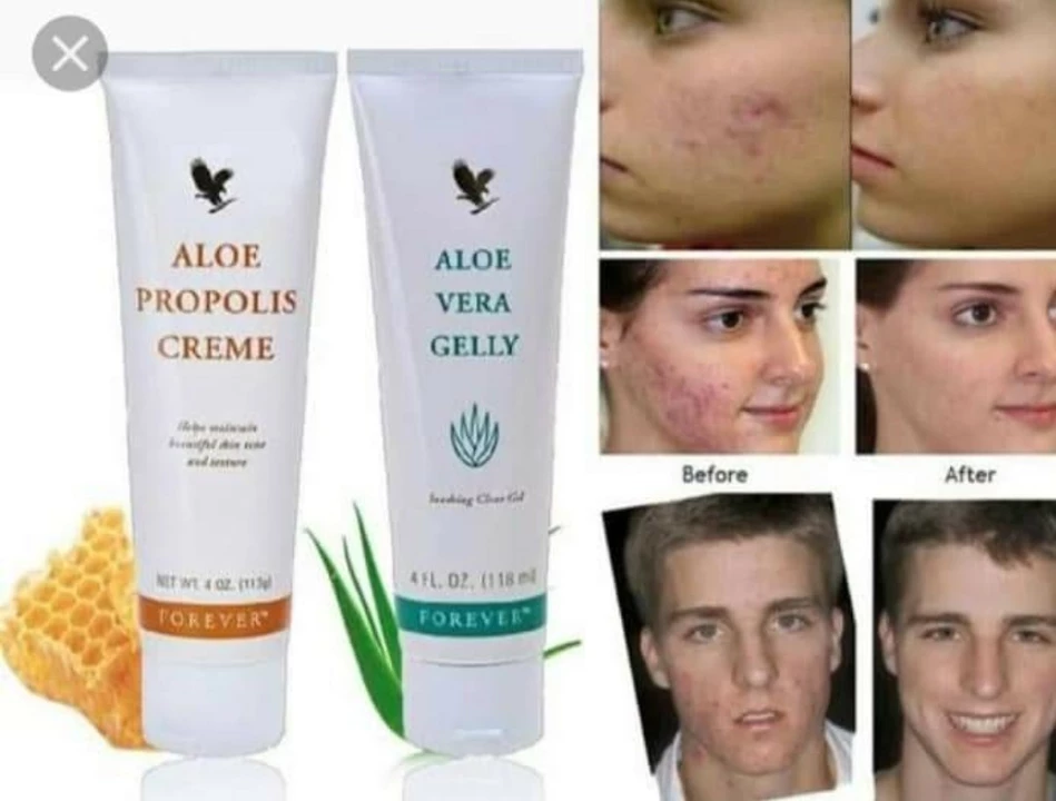 PROPOLIS CREAM ,ALOE VERA JELLY  uploaded by business on 12/7/2022