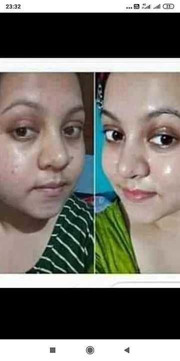 Skin treatment uploaded by New Khushi collection on 2/7/2021