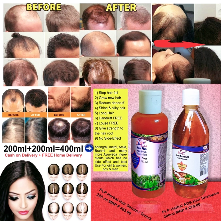 1) Stop hair fall 
2) Grow new hair 
3) Reduce dandruff
4) Shine & silky hair 
5) Long Hair
 uploaded by PLP Production and Marketing Pvt Ltd on 1/5/2023