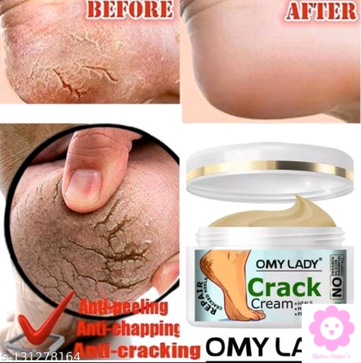 Post image Only for prepaid order 💳📲Catalog Name:*OMY LADY Sensational Nourshing Foot Cream*Brand: OthersFlavour: SandalwoodNet Quantity (N): 1Dispatch: 1 Day
*Proof of Safe Delivery! Click to know on Safety Standards of Delivery Partners- https://ltl.sh/y_nZrAV3
