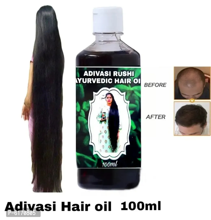 Hair oil uploaded by Online Shopping ND on 2/7/2023