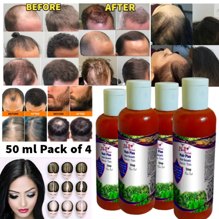 50ml Hair Vitalizer uploaded by PLP Production and Marketing Pvt Ltd on 5/28/2024