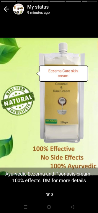 Eczema Ayurvedic treatment cream  uploaded by ABs Shopper Shop on 3/15/2023