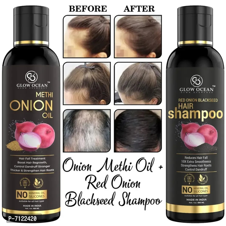 Onion oil and shampoo  uploaded by Reseller  on 5/25/2023