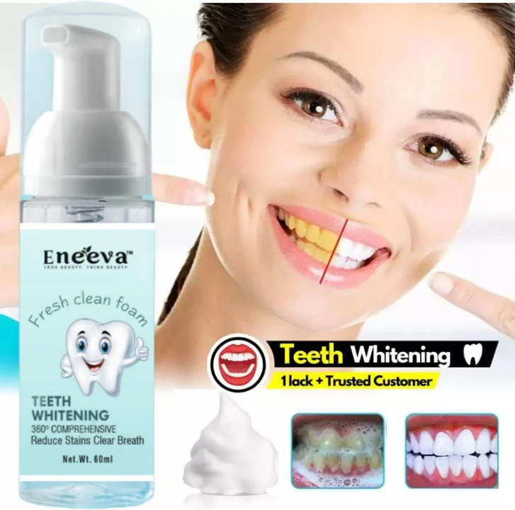 Teeth whitening faom uploaded by business on 5/29/2023