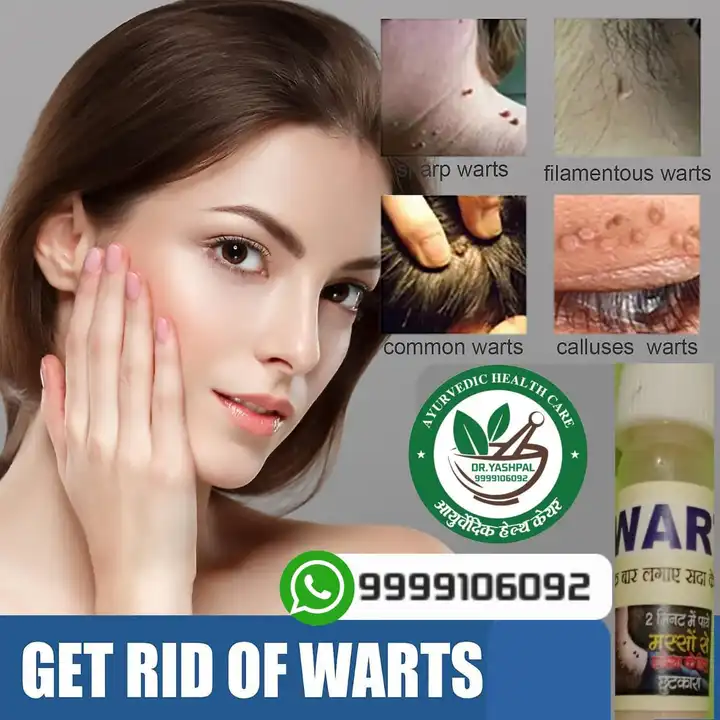 Wart uploaded by DR.YASHPAL HEALTH CARE on 6/21/2023