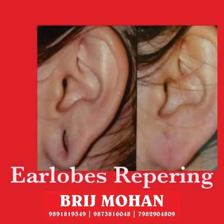 EAR LOBE PRODUCT uploaded by business on 6/27/2023