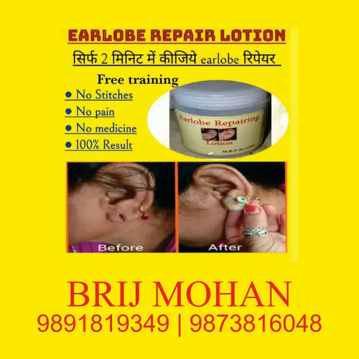EAR LOBES PRODUCT 3000 MRP AFTER DISCOUNT 2000 uploaded by business on 7/30/2023