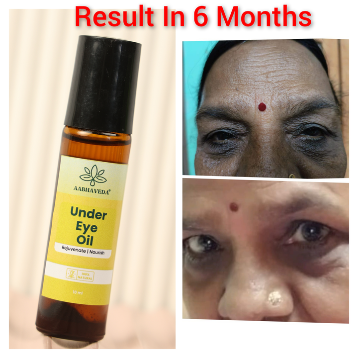 Under Eye Oil  uploaded by Aabhaveda  on 9/8/2023