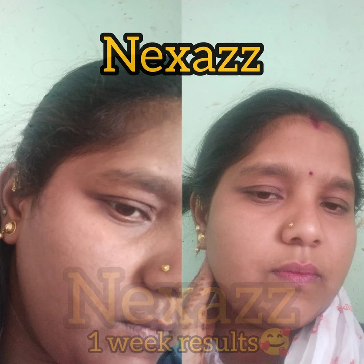 Nexazz face and neck cream Brightening  uploaded by Nexazz on 12/11/2023