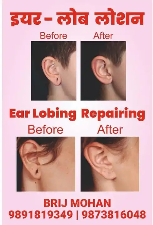EAR LOBE REPAIRING LOTION  uploaded by COSMO AIR BRUSH MACHINE on 3/9/2024