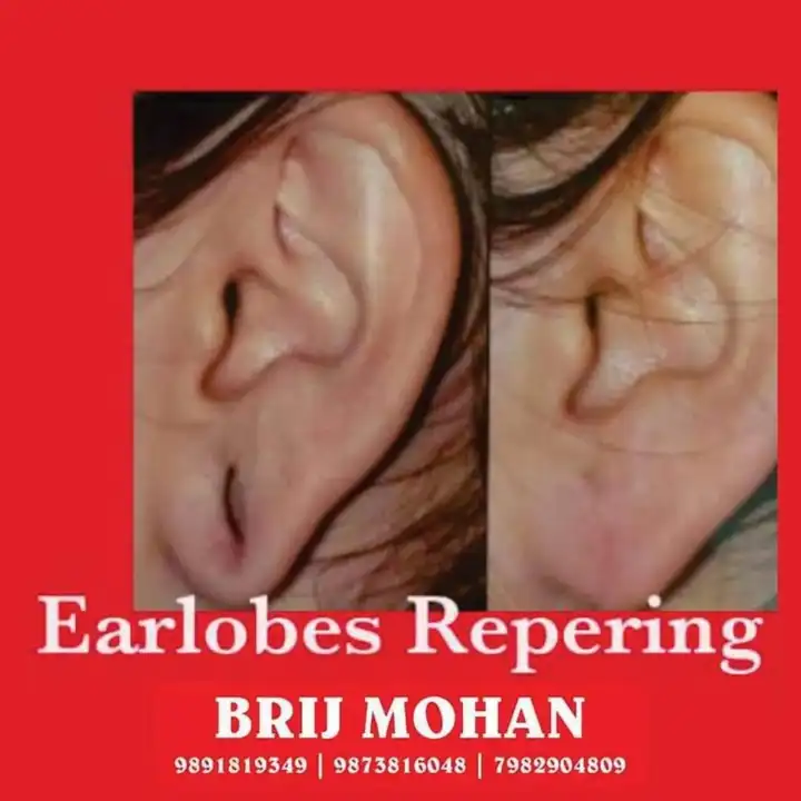 EAR LOBE REPAIRING LOTION  uploaded by business on 3/9/2024