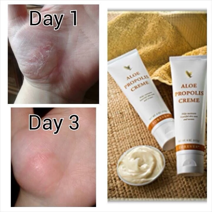 Propolis creme uploaded by Health and beauty products on 3/22/2024