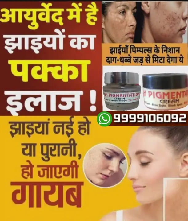 PIGMENTATION CREAM  uploaded by DR.YASHPAL HEALTH CARE on 4/26/2024