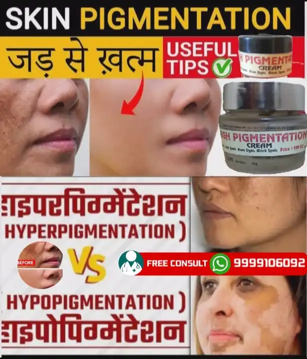 PIGMENTATION CREAM  uploaded by DR.YASHPAL HEALTH CARE on 4/26/2024