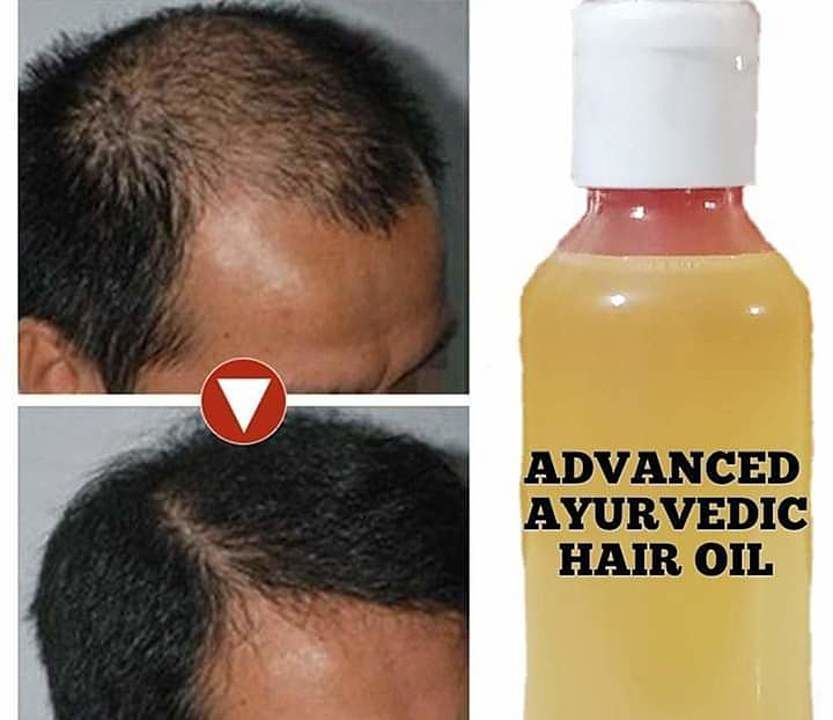 Aurvedic Hair oile uploaded by business on 7/31/2020