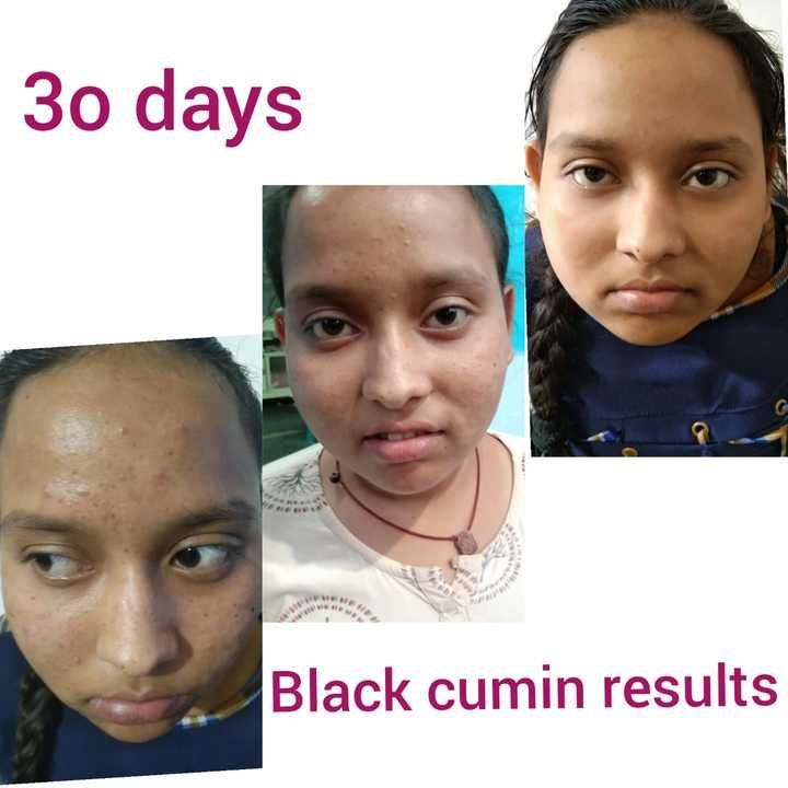 Black cumin soap uploaded by Almira online store  on 5/28/2021