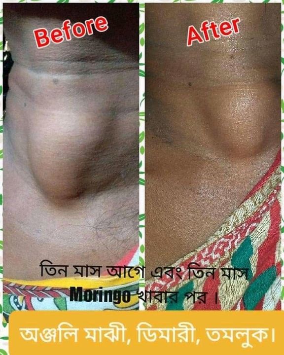 Phytoshine uploaded by Sonu new collection on 6/20/2021