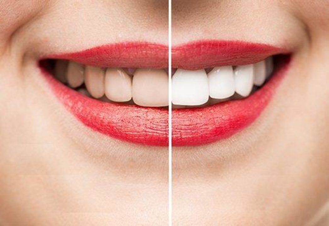 Ayurvedic Teeth Whitening Powder No Side Effect Free Shipping Cash On Delivery Available uploaded by business on 7/29/2021