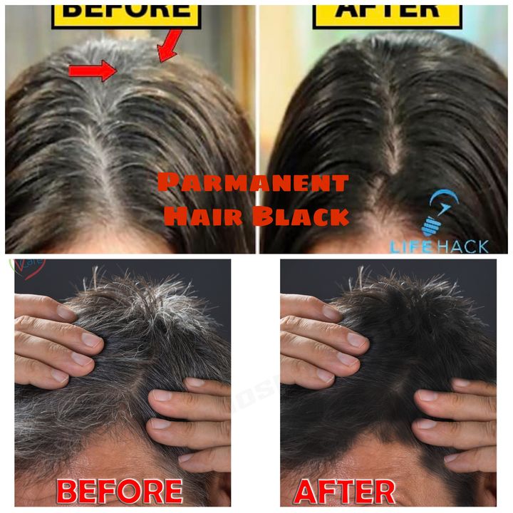 New hair growth and hair loss stop. uploaded by business on 7/29/2021