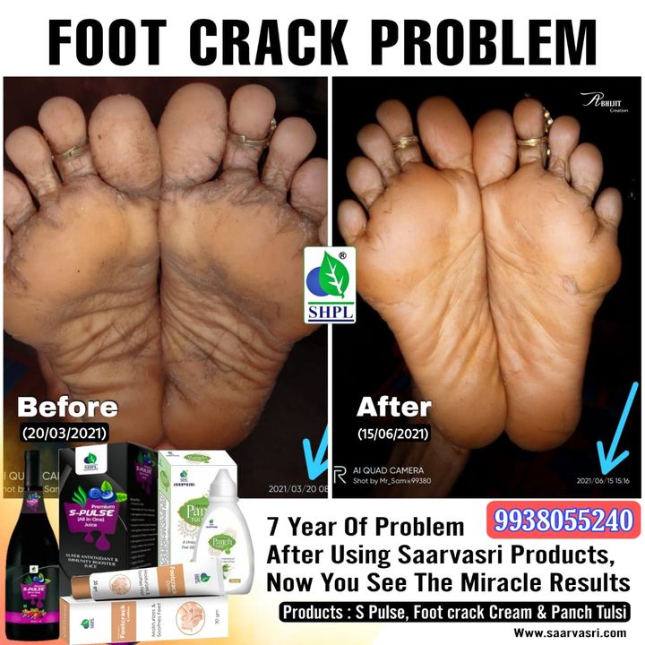 Footcrack Problem uploaded by business on 8/6/2021