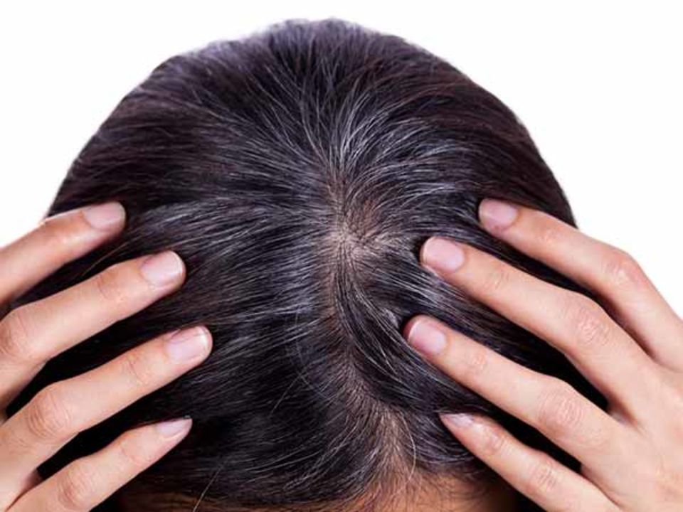 White hair problem solution kit uploaded by Rahul Verma on 8/27/2021