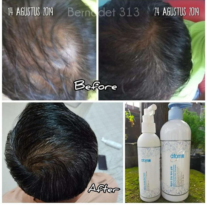 Atomy hair shampoo & tonic  uploaded by business on 9/2/2021