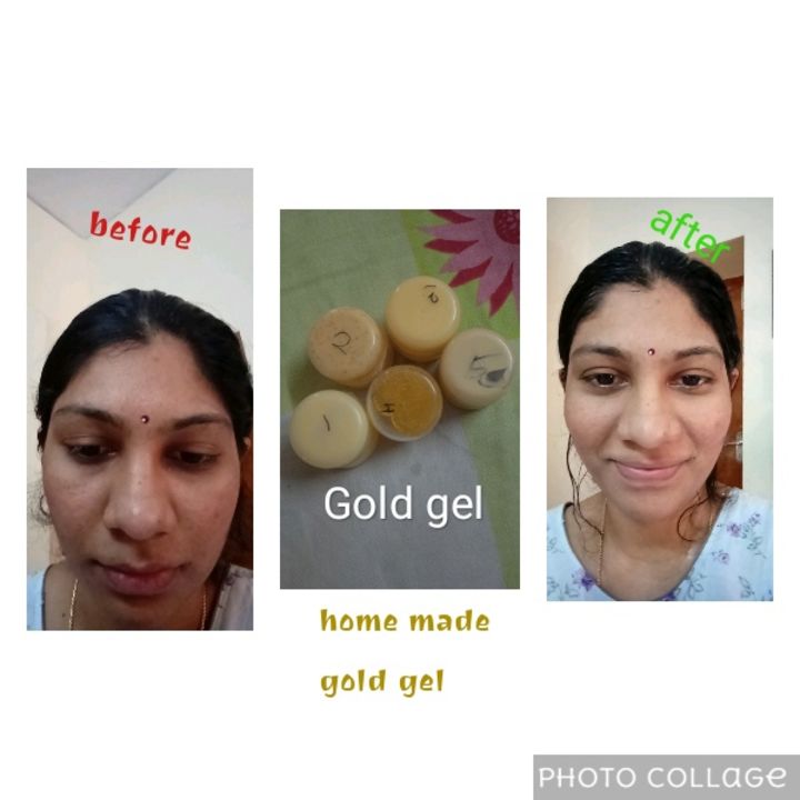 Gold facial kit uploaded by business on 9/17/2021
