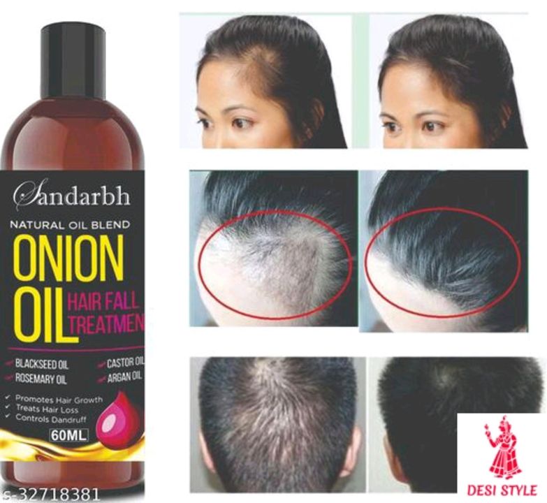 Post image WhatsApp 9839861924Rs 249/- Free home delivery👌 🙏🙏🙏
Sandarbh Onion Oil for Hair Regrowth &amp; Hair Fall Control Hair Oil Product Name: Sandarbh Onion Oil for Hair Regrowth &amp; Hair Fall Control Hair Oil Brand Name: SANDARBHCapacity: 60 mlMultipack: 1Flavour: OnionSandarbh tress, pollution &amp; unhealthy lifestyle choices can lead to many hair troubles - hair fall being the most common one. Mamaearth's Onion Hair Oil helps you combat this problem. Onion Oil, rich in Sulphur, Potassium &amp; antioxidants, reduces hair fall &amp; accelerates hair regrowth. One of the newest breakthrough ingredients in hair regrowth, Redensyl, unblocks hair follicles &amp; also boosts new hair growth.
Country of Origin: India