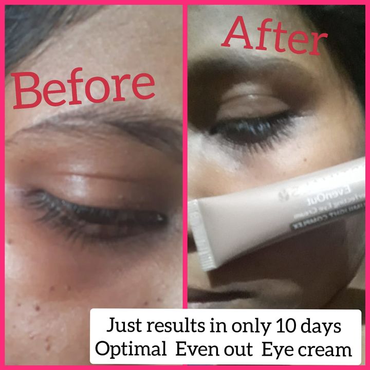 Eye cream uploaded by Swathi Enterpenuer on 11/3/2021