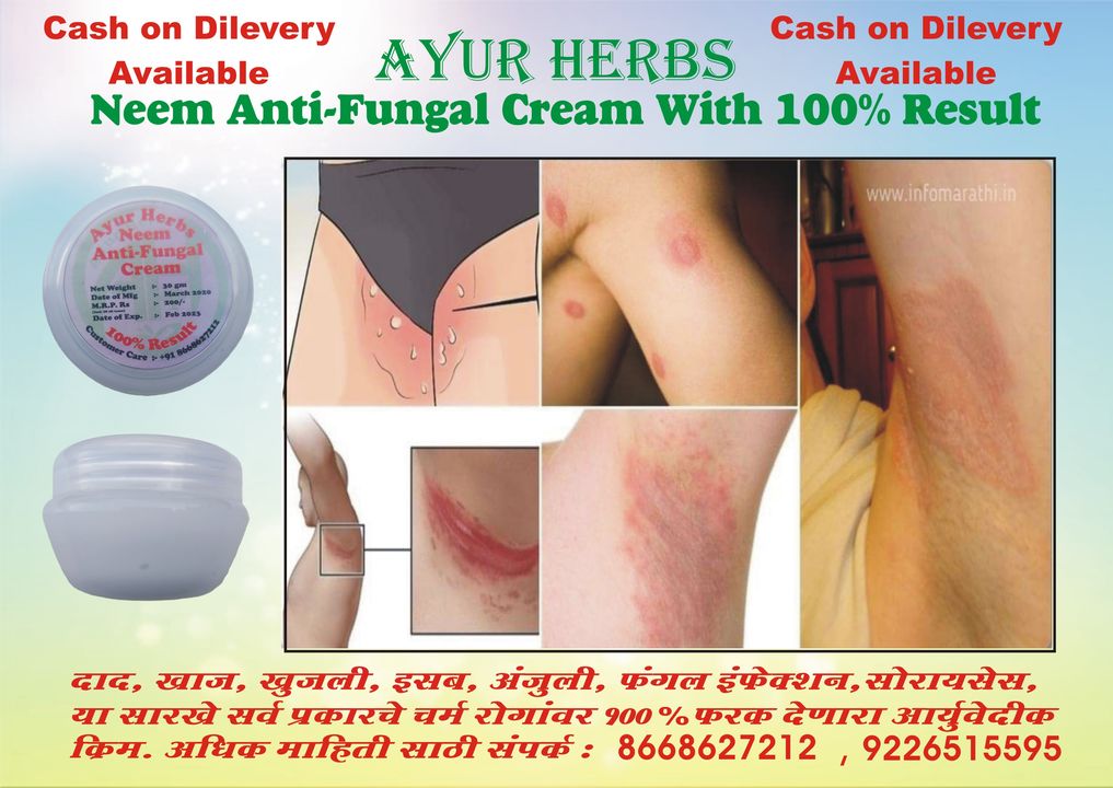 Antifungal Cream uploaded by Ayur Herbs Marketing on 11/7/2021