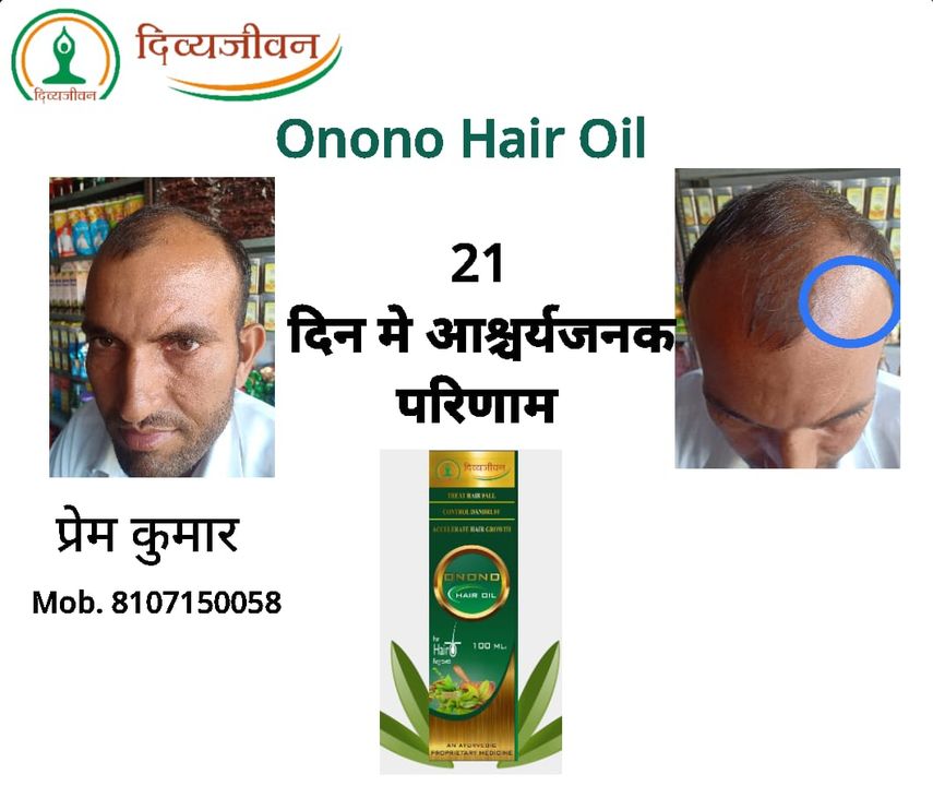 Post image Onono hair oil