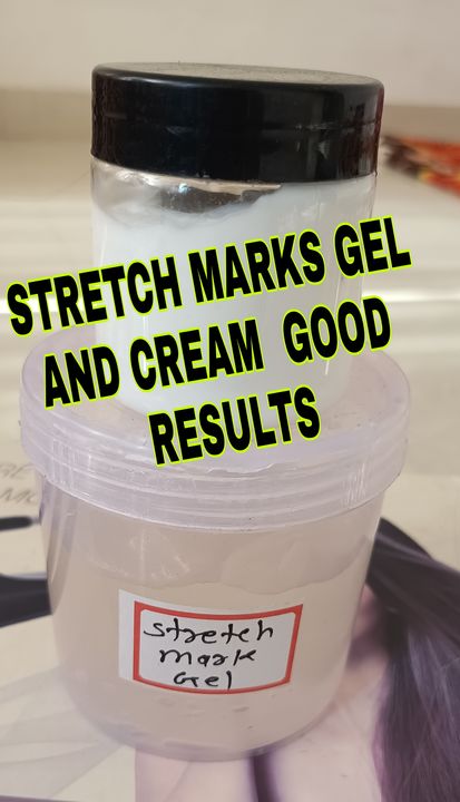 STRETCH MARKS REMOVE CREAM & GEL  PURE AYURVEDIC PRODUCTS 101% RESULT IN 15 DAYS  uploaded by business on 12/12/2021