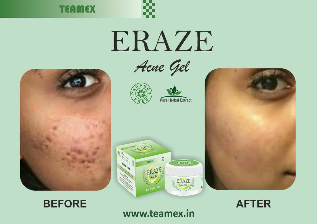 Acne gel uploaded by business on 12/19/2021