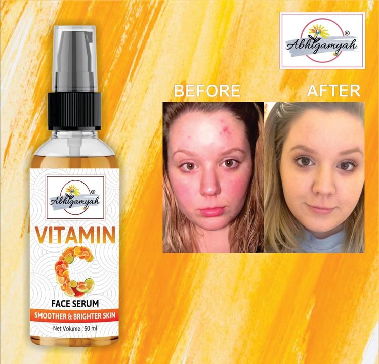 Vitamin c face serum uploaded by Khushi sales on 1/9/2022