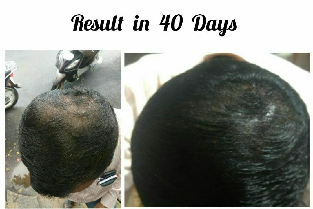 Secure Ayurvedic hair oil uploaded by V fix solution on 2/3/2022