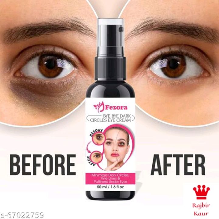 Eye dark circles remove oil uploaded by Avy online shopping on 2/9/2022