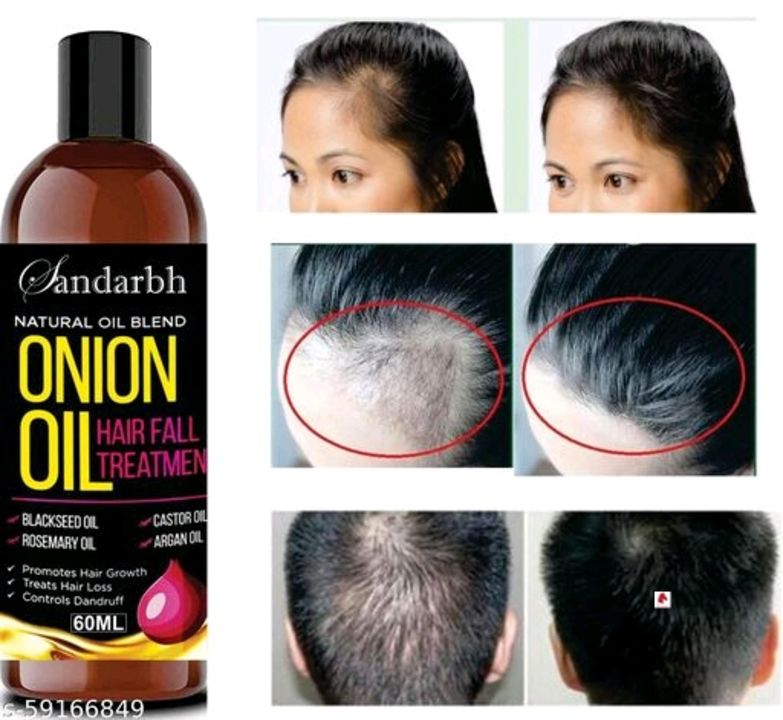 Post image Sandarbh Onion Hair Oil for Hair Fall Control | 60 ml | Pack of 1 | Hair Fall treatment | blend of multiple essential Oil | Protects and Nourish hair | Onion | Hair Regrowth | Black Seed Oil | Strong and Shine | Vitamin E | Dandruff Control | Rosemary Oil | Treats Hair Loss | Argan Oil | Non Sticky | Boost Hair Growth | Nourish The Scalp | Without Sulfates and ParabenProduct Name: Sandarbh Onion Hair Oil for Hair Fall Control | 60 ml | Pack of 1Brand Name: SandarbhMultipack: 1Flavour: OnionSandarbh Onion Oil for Hair Regrowth &amp; Hair Fall Control Hair Oil Pack of 1
Country of Origin: India