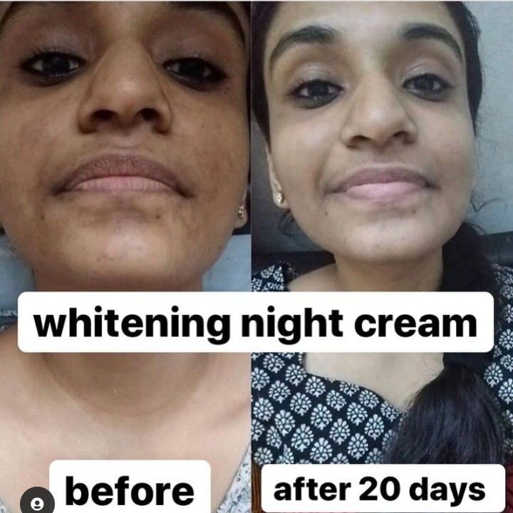 Whiting cream nd pack uploaded by Beautystore nd suits on 2/21/2022