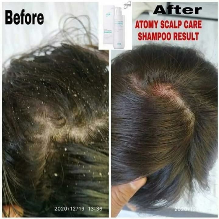 Atomy hair tonic atomy scalpcare hair shampoo uploaded by Atomy India on 4/6/2022