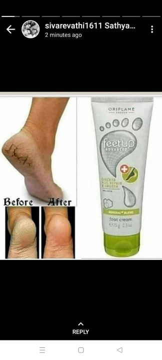 Foot 👣 Cream uploaded by Sai fashions on 4/20/2022