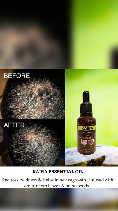 Anti hairloss oil uploaded by Kaira skin care manufacturers  on 5/1/2022