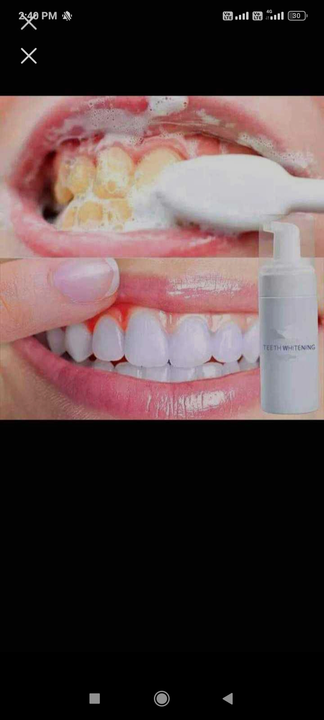 Teeth whitening product  uploaded by business on 5/15/2022