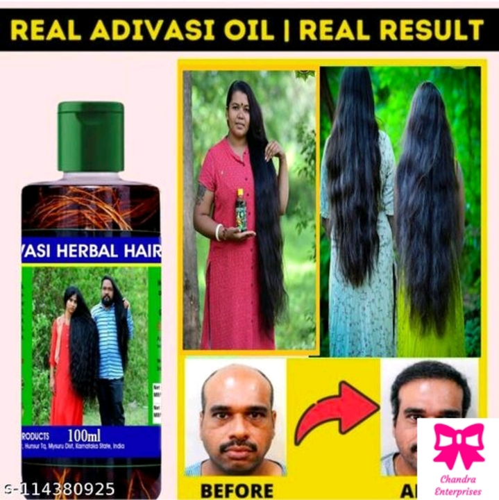Adivasi harbal hair oil uploaded by business on 6/17/2022