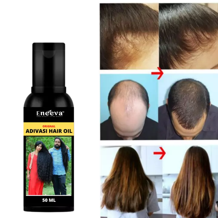 Eneeva adivasi hair oil uploaded by Eneeva cosmetic on 6/18/2022