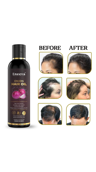 Eneeva Onion hair oil For Hair Fall Control, Hair Growth,Hair Regrowth,onion hair oil uploaded by business on 6/19/2022