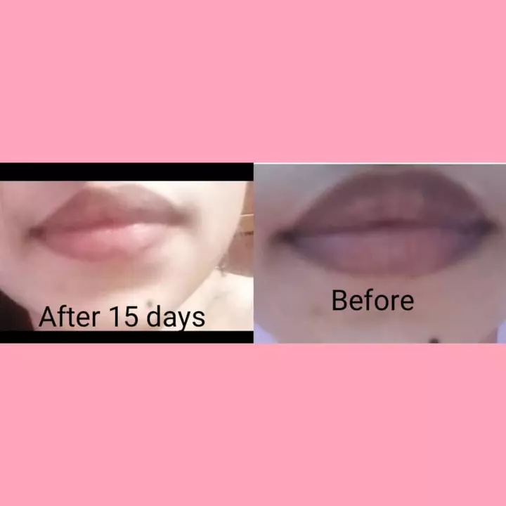 Lip lightning cream uploaded by Simplify lifestyle on 6/22/2022