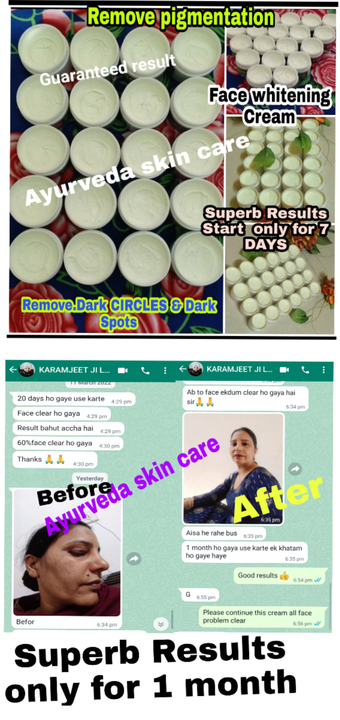 STAR BEAUTY.. WHITENING.. CREAM WITH 100% 👉EFFECTIVE RESULTS HOME MADE NIGHT FAIRNESS CREAM FOR 👉B uploaded by business on 7/7/2022